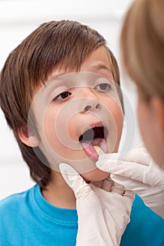 Boy showing her throat to health professional