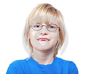 Boy showing missing milk teeth