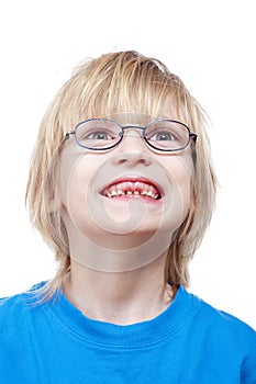 Boy showing missing milk teeth