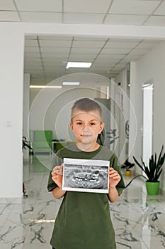 A boy is standing in a dental clinic with a picture of his teeth in his hands. Portrait of a boy with an x-ray
