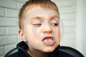 A boy of 6-7 years old shows the first teeth that grow after the loss of milk teeth. Closeup of a boy's face