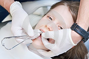 Braces for child teeth correction. Installation and maintenace