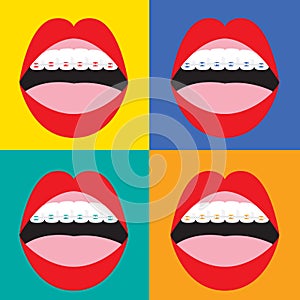 Braces Corrective Orthodontics On Colorful Background