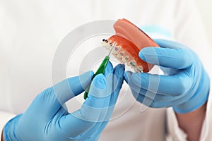 Braces model with brush