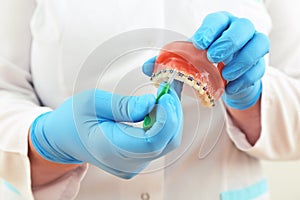 Braces model with brush