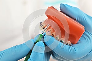 Braces model with brush