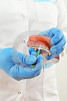 Braces model with brush