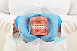Braces model