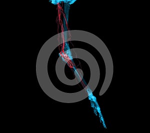 Brachial Arteries of the arm with Upper extremity Bone 3D rendering from CT Scanner