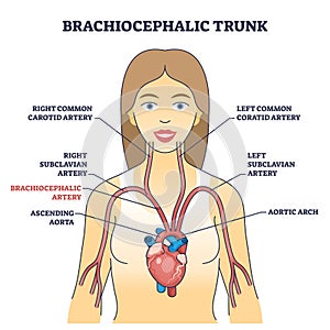 Brachiocephalic trunk anatomy with innominate blood artery outline diagram