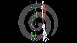 Brachioradialis muscle. Pain and trigger points in the hand