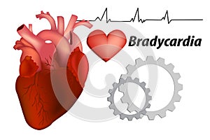 Bradycardia.  Sinus bradycardia and Sick sinus photo