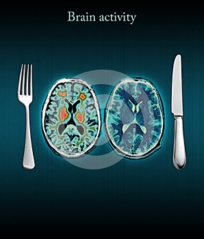 Brain activity