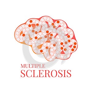Brain affected by multiple sclerosis