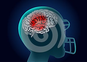 Brain of American football player have a red signal.