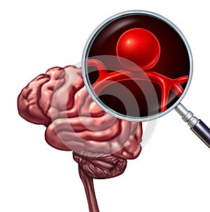 Brain Aneurysm Concept