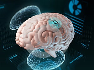 Brain chip concept