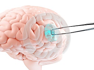 Brain chip concept