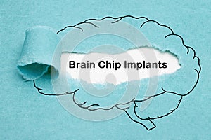 Brain Chip Implants Technology Concept