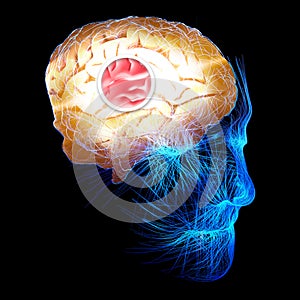 Brain connections. Neurons and synapses. Neural network circuit, degenerative diseases, Parkinson, Alzheimer.