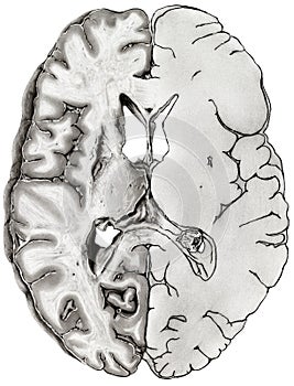 Brain - Cross Section