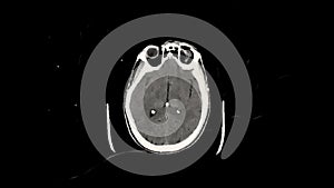 Brain CT, axial view with glitches and scratches