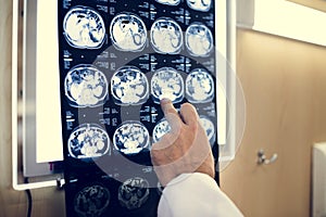 Brain CT scan x-ray film