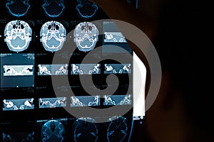 Brain CT scan x-ray film image Brain