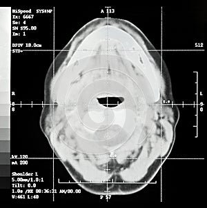 Brain CT Slice