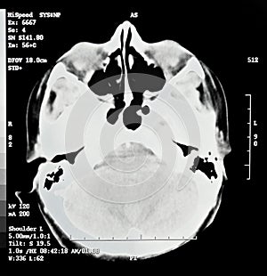 Brain CT View