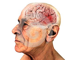 Brain, Degenerative Diseases, Alzheimer`s, Parkinson`s. Old man photo