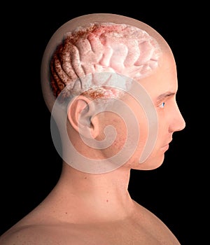 Brain, degenerative diseases, Parkinson`s, human body, face photo