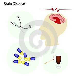 Brain Disease Concept with Disease Treatment photo