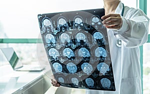 Brain disease diagnosis with medical doctor seeing Magnetic Resonance Imaging MRI film diagnosing elderly ageing patient photo