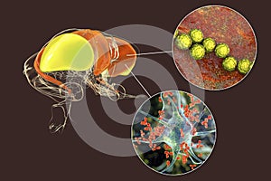 Brain disease due to streptococcal infection and anti-basal ganglia antibodies, 3D conceptual illustration photo