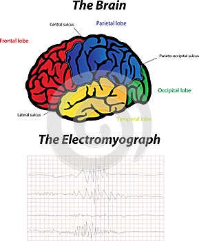 Brain and Electromyograph