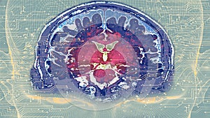 Brain image from MRI in concept AI