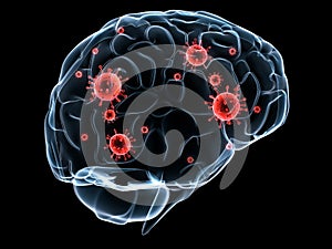 Cerebro infecciones 