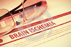 Brain Ischemia. Medicine. 3D Illustration. photo