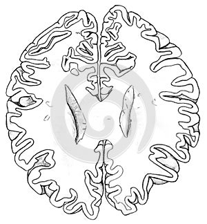 Brain - Lower Region Cross Section