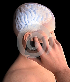 Brain, Man with Cell Phone, Brain Problems, Cause Of Tumor, Degenerative Diseases, Parkinson`s, Profile Face