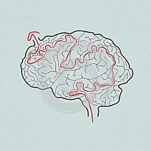Brain maze with correct path