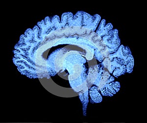 Brain MRI CT Scan