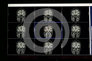 Brain MRI for education