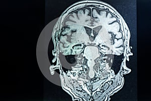 Brain MRI for education