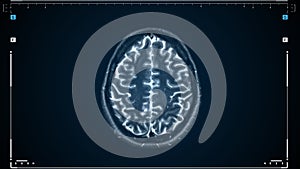 Brain mri scan. Scanning of brain's magnetic resonance image. Diagnostic medical tool.