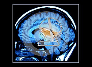 Cerebro escanear ratón redondo 