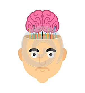 Brain in an open head with wires. Nerve cell stimulation