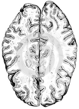 Brain - Sagittal Region Cross Section