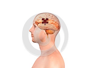 Brain shaped white jigsaw puzzle on white background, a missing piece of the brain puzzle, mental health and problems with memory